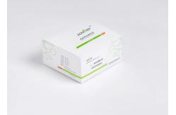 China Ardiology ICU Troponin I Rapid Test Kit D-Dimer One Step Rapid Test supplier
