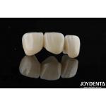 Natural-looking Style With Layers Full Zirconia High Translucency And Aesthetics