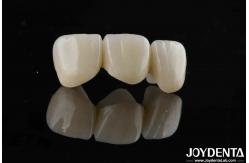 China Natural-looking Style With Layers Full Zirconia High Translucency And Aesthetics supplier
