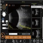 Mini Ultrasound Scanner Machine With Intelligent Digital Software Multiple IOL Calculation Formulas for sale