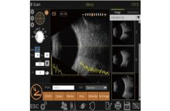 China Mini Ultrasound Scanner Machine With Intelligent Digital Software Multiple IOL Calculation Formulas supplier