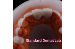 China Abrasion Resistant Emax Zirconia Laminate Veneers Incisal Translucency supplier