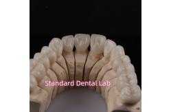 China Digital CAD CAM Dental Lab PFZ Crowns Translucent Layered Zirconia Crown supplier