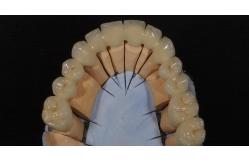 China Good Fitting Good Esthetics Multi Layered Zirconia Crown Porcelain Zirconia Bridge supplier