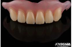 China High Stealth Flexible Removable Denture Finished Comfortable Fit Dental Lab supplier