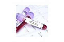 China UV Printing OPP Medication Warning Labels For Blood Collection Tube supplier