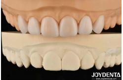 China Lightweight Property Flexible Denture Finish Personalized Customization For Diverse Specifications supplier