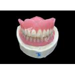 BPS suction dentures as an effective removable denture solution for enhanced comfort and stability for sale