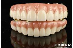 China High Durability Ti-Bar Zirconia Hybrid Bridge For Achieving Aesthetics supplier
