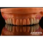 Framework Setup Teeth Finish Elaborate Technology Beautiful Harmonious Appearance Design for sale