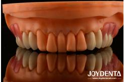 China Framework Setup Teeth Finish Elaborate Technology Beautiful Harmonious Appearance Design supplier