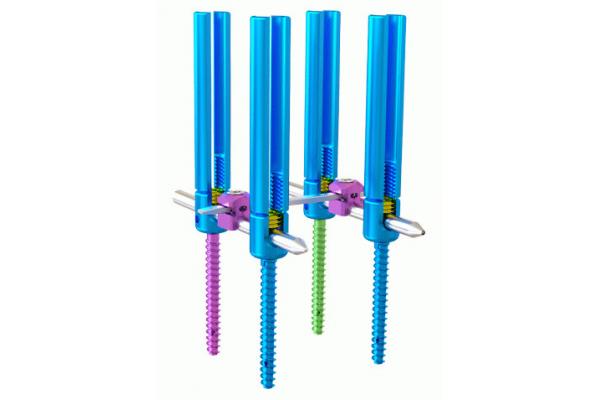 Internal Spinal Fixation System Type Ⅰ Minimally Invasive