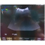 Medical Ultrasound Equipment Repair Hitachi HI VISION Avius Bright Channels Faulty for sale