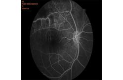 China High Resolution Automated Fundus Camera with FFA or FAF, mosaic function supplier