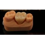 Mill and Centring Full Zirconia Crown , China Dental Lab Fast Delivery for sale