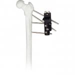 View larger image video-iconimage image Add to CompareShare Competitive Price Orthopedic Surgical Instruments Hip Joint for sale