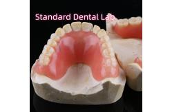 China High Esthetic Acrylic Partial Denture Dental Resin Dentures With Base supplier