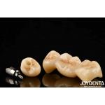 Multilayer Full Zirconia High Resistance To Cracking And Durability For Long-Lasting Dental Restorations for sale