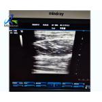 Mindray DC-3 Abnormal Image Ultrasound Machine Repair Solutions Health Medical Equipment for sale