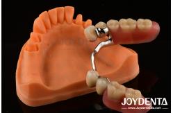 China Framework Setup Teeth Finish Elaborate Technology Beautiful Harmonious Appearance Design supplier
