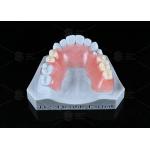 TCS Flexible Partial Stain Resistant BPA Free Partial Dentures For Natural Look for sale