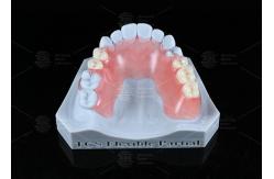 China TCS Flexible Partial Stain Resistant BPA Free Partial Dentures For Natural Look supplier