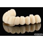 Customizable Ti-Base Zirconia Hybrid Bridge With Excellent Durability And Good Biocompatibility