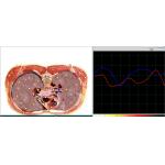 Meridian Test Metatron Nls 4025 Hunter Body Analyzer Health Diagnostic Machine