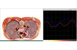 China Meridian Test Metatron Nls 4025 Hunter Body Analyzer Health Diagnostic Machine supplier