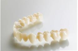 China Temporary PMMA Temporary Crown supplier