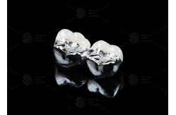China Co Cr Ceramic PFM Restorations Cad Cam Pfm Crown Natural Looking supplier