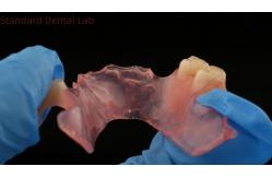 China Dental TCS Valplast Flexible Partial Dentures Dental Lab 3D Print Model High Esthetics supplier