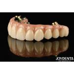 Custom-made Ti-Bar Zirconia Hybrid Bridge Resistant To Corrosion And Wear Restoring Chewing Function With Precision for sale