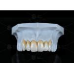 High Translucency Full Contour Zirconia Bridge Chipping Resistance Natural Esthetics