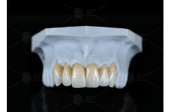China High Translucency Full Contour Zirconia Bridge Chipping Resistance Natural Esthetics supplier