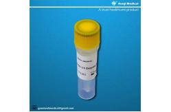 China 95% Sensitivity Sars-Cov-2 Home Test Kit Oropharyngeal Nasopharyngeal supplier