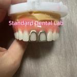 ISO Full Acrylic Dentures With Yellow Gold Teeth Open Face for sale