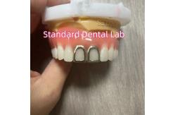 China ISO Full Acrylic Dentures With Yellow Gold Teeth Open Face supplier
