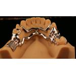 Upper Cast Metal Framework Partial Dentures Strong Lightweight And Durable for sale