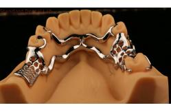 China Upper Cast Metal Framework Partial Dentures Strong Lightweight And Durable supplier
