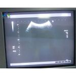 Toshiba PVT-382BT Abdominal Ultrasound Transducer Probe 5.5 MHz