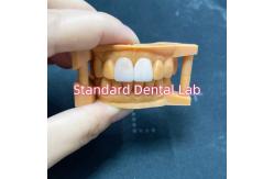 China High Colour Stability Ivoclar Emax Laminate Veneers High Translucency supplier