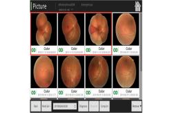 China Hyper Static Non Mydriatic Fundus Camera Machine 180 Degrees supplier