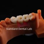 Porcelain Zirconia Dental Implant Bridge Professional High Esthetics for sale