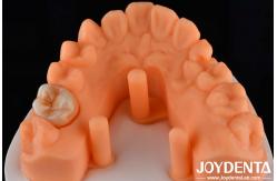 China Customizable Adhesive Zirconia Inlays Onlays High Translucency For Restoration supplier