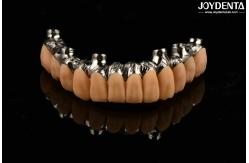 China Yellow Resin Temporary Teeth Smooth Surface Treatment Precise And Stable supplier