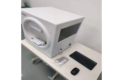 China Static Visual Field Analyzer CE Optic Atrophy Real Time Assessment supplier