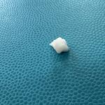 Advanced Filling Effect On Marionette Lines With Calcium Hydroxyapatite Injection for sale