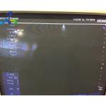 Siemens P4-2 Phased Array Ultrasound Transducer Probe Siemens Original Probe