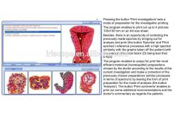 China Super Health Analyzer Machine Body Analyzer Machine Support win7/8/10 supplier